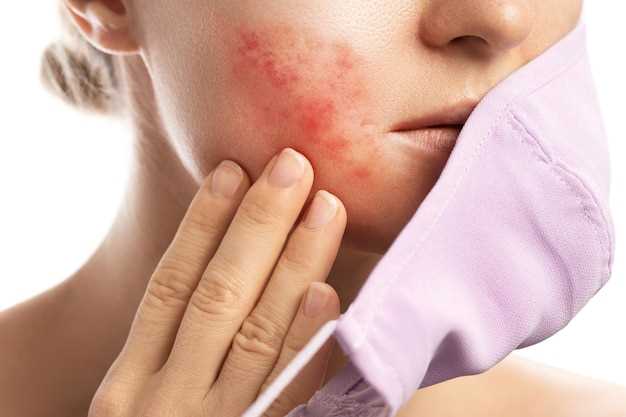 Эффективные методы устранения красных пятен на лице при аллергии