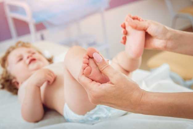 Эффективные методы лечения опрелости у младенца