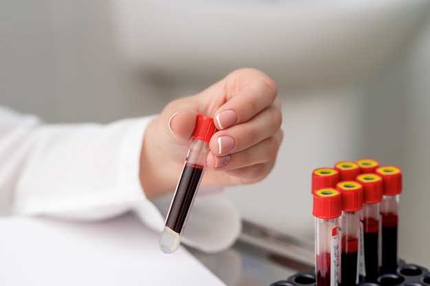 Как правильно интерпретировать показатели общего анализа крови при подозрении на анемию
