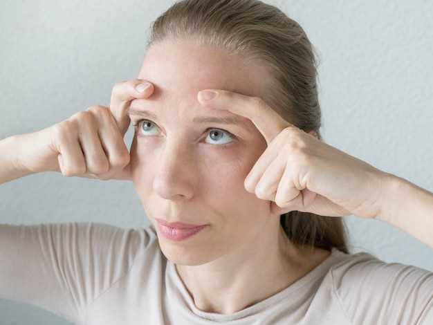 Рекомендации по предотвращению появления синяков под глазами