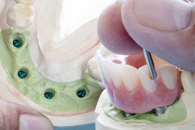 Как проводят исследование и лечение кисты зуба у стоматолога