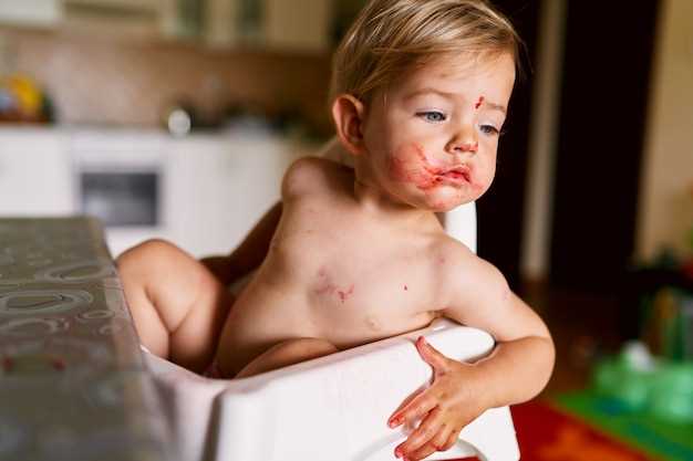 Советы по уходу за кожей ребенка при крапивнице
