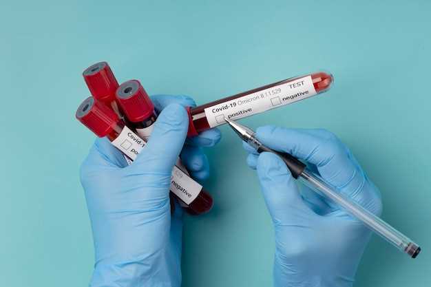 Важность анализа на свертываемость крови для диагностики и профилактики заболеваний