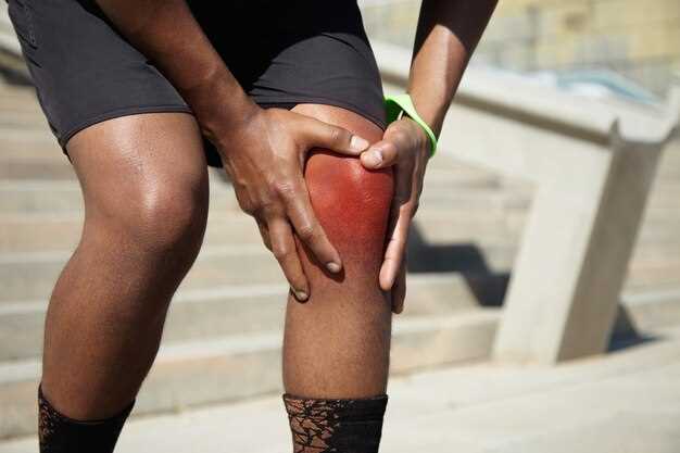 Когда болит колено: первые шаги