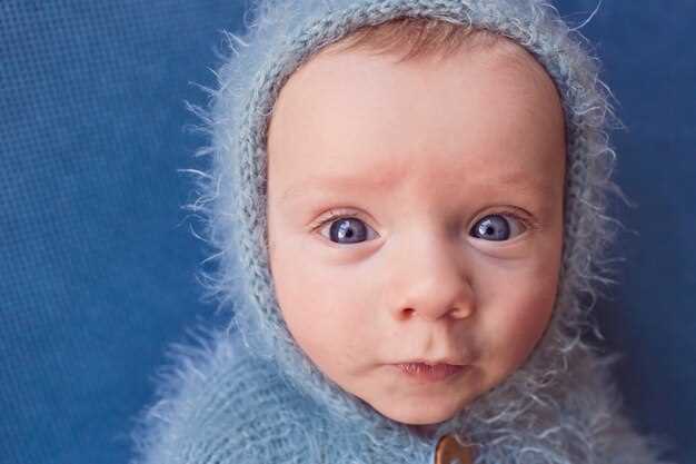Косоглазие у младенцев: причины и особенности