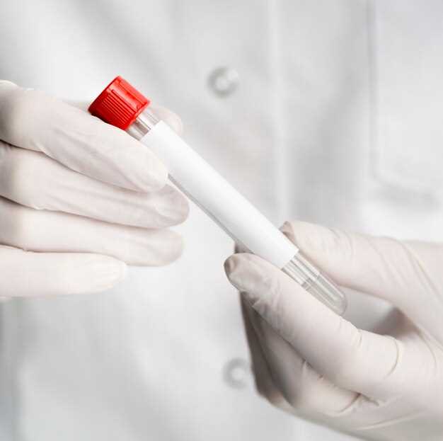 Как определяются лимфоциты в анализе крови