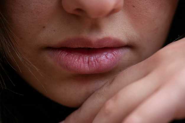Причины темного оттенка малых половых губ