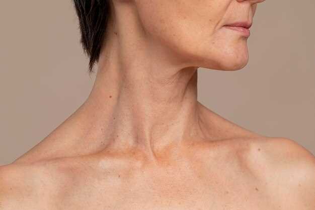 Методы предотвращения и лечения холки на шее у женщин