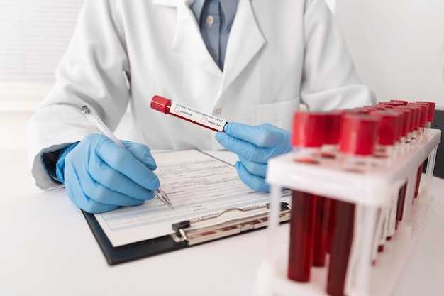 Важность биохимического анализа крови для диагностики
