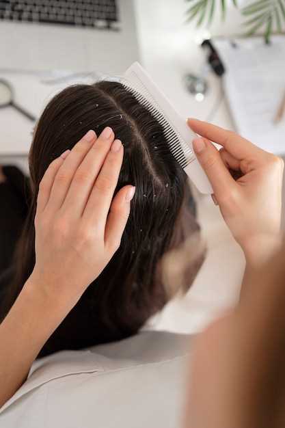 Потеря волос из-за стресса: причины и меры предосторожности